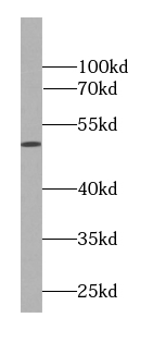 HDAC3-specific antibody|HDAC3抗