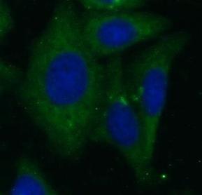 ECM1 antibody|ECM1抗体