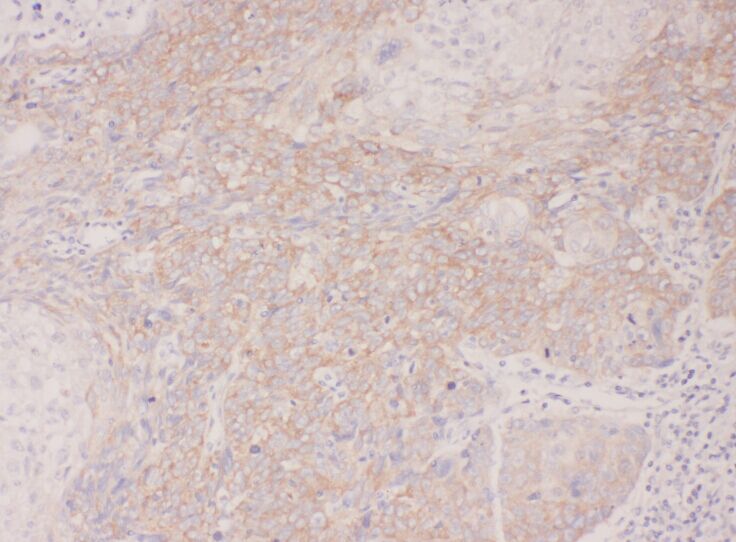 ACAP1 antibody|ACAP1抗体