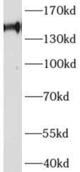 AFF4 antibody|AFF4抗体 FNab00196