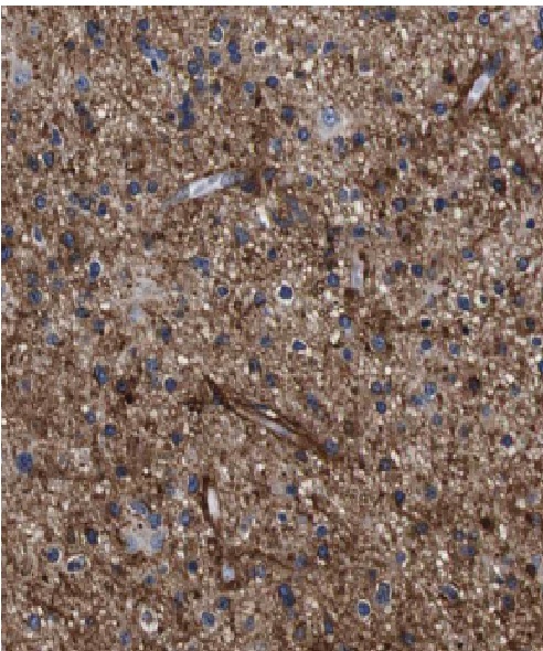 FABP7 antibody|FABP7抗体 FNab029