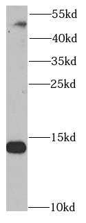 SNRPD2 antibody|SNRPD2抗体 FNab0