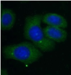 CXCL14 antibody|CXCL14抗体