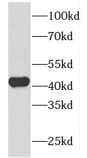 FOXQ1 antibody|FOXQ1抗体