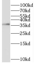 TNNT2 antibody|TNNT2抗体 FNab099