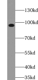 ACAP3 antibody|ACAP3抗体