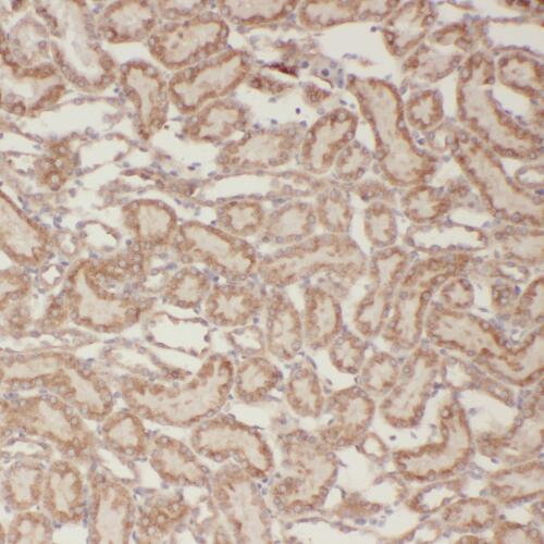 TBC1D1 antibody|TBC1D1抗体
