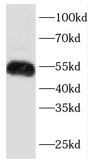 KRT7 antibody|KRT7抗体 FNab02217