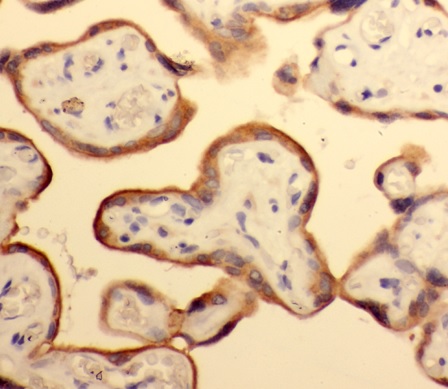 NECTIN4 antibody|NECTIN4抗体