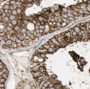 DNAH14 antibody|DNAH14抗体