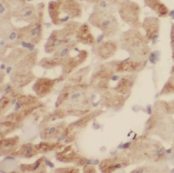 SDHB antibody|SDHB抗体