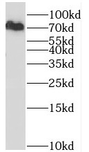 RBM14 antibody|RBM14抗体