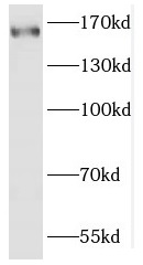 FGD5 antibody|FGD5抗体