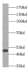 PGAP3 antibody|PGAP3抗体