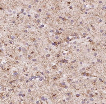 EIF4G3 antibody|EIF4G3抗体