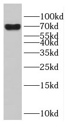 ENTPD2 antibody|ENTPD2抗体