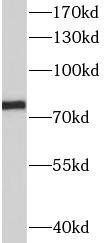 SLC34A2 antibody|SLC34A2抗体 FNa