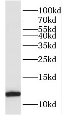 FKBP1B antibody|FKBP1B抗体