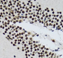 TXNL1 antibody|TXNL1抗体