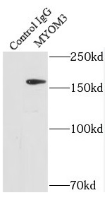 RIOX2 antibody|RIOX2抗体