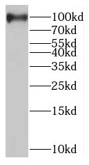 MAGED1 antibody|MAGED1抗体 FNab0