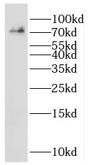 IDUA antibody|IDUA抗体