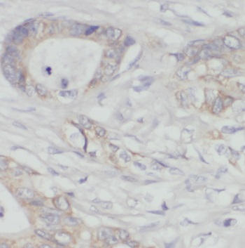 PDHX antibody|PDHX抗体