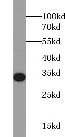 NQO1 antibody|NQO1抗体