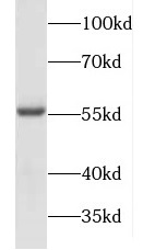FOXC2 antibody|FOXC2抗体