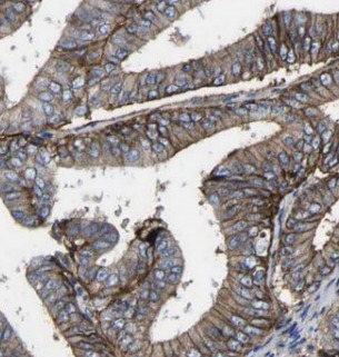 CD47 antibody|CD47抗体