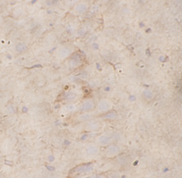 VHL antibody|VHL抗体 FNab10175