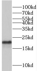 TRAPPC3 antibody|TRAPPC3抗体