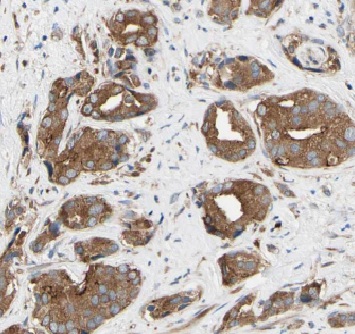 ETFDH antibody|ETFDH抗体