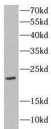 CLDN11 antibody|CLDN11抗体