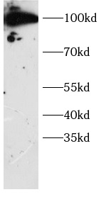 DTL antibody|DTL抗体 FNab10365