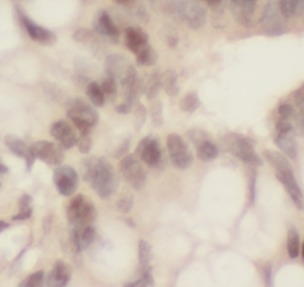 THOC1 antibody|THOC1抗体