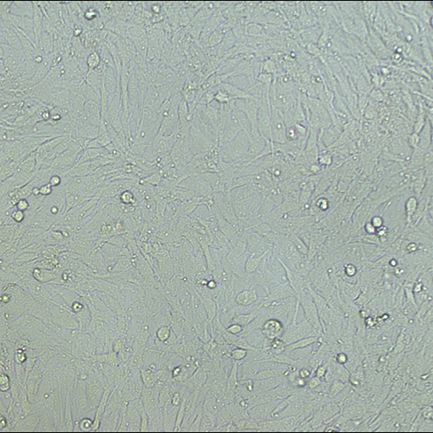 过表达稳定细胞株构建