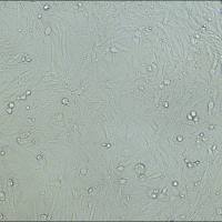 过表达稳定细胞株构建