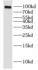 DLGAP5 antibody|DLGAP5抗体