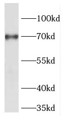 FOXC1 antibody|FOXC1抗体