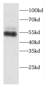 CADM1 antibody|CADM1抗体 FNab011