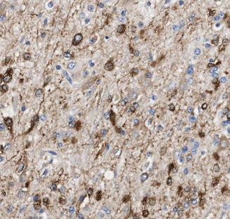 ALG1 antibody|ALG1抗体