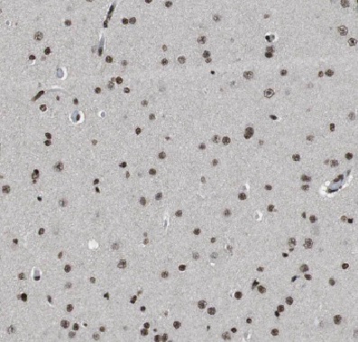 COPS8 antibody|COPS8抗体