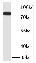 TLE3 antibody|TLE3抗体 FNab08721