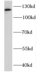DDX46 antibody|DDX46抗体