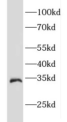 EEF1B2 antibody|EEF1B2抗体 FNab0