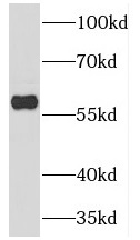 TESPA1 antibody|TESPA1抗体
