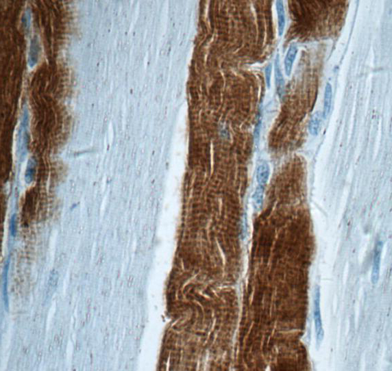 TNNI2 antibody|TNNI2抗体 FNab088