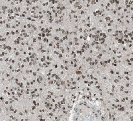 LCK antibody|LCK抗体 FNab04725