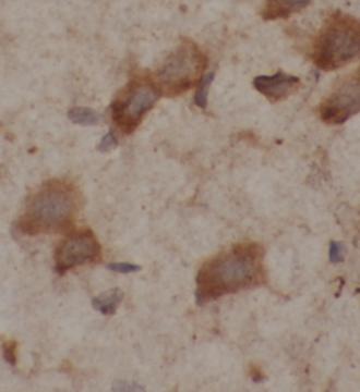 GRIN2B antibody|GRIN2B抗体 FNab0